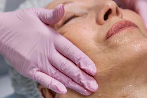 Complete Skin Renewal Laser Facial (Laser Genesis + Enzyme Therapy) | (Buy 5, Get the 6th Free)